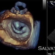 Echocardiography