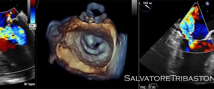 Echocardiography