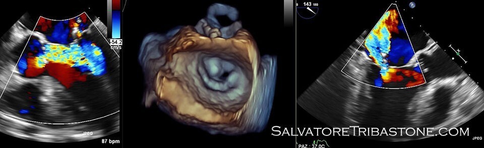 Echocardiography