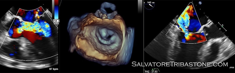 Echocardiography